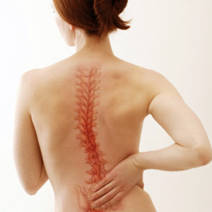 scoliosis-treatment2